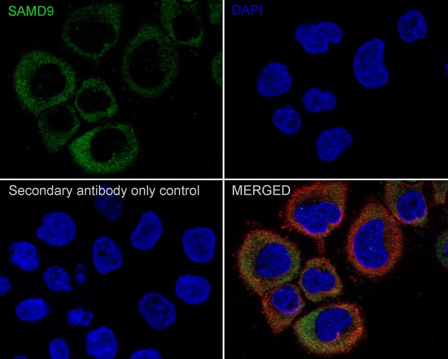 SAMD9 Antibody (PSH02-75)