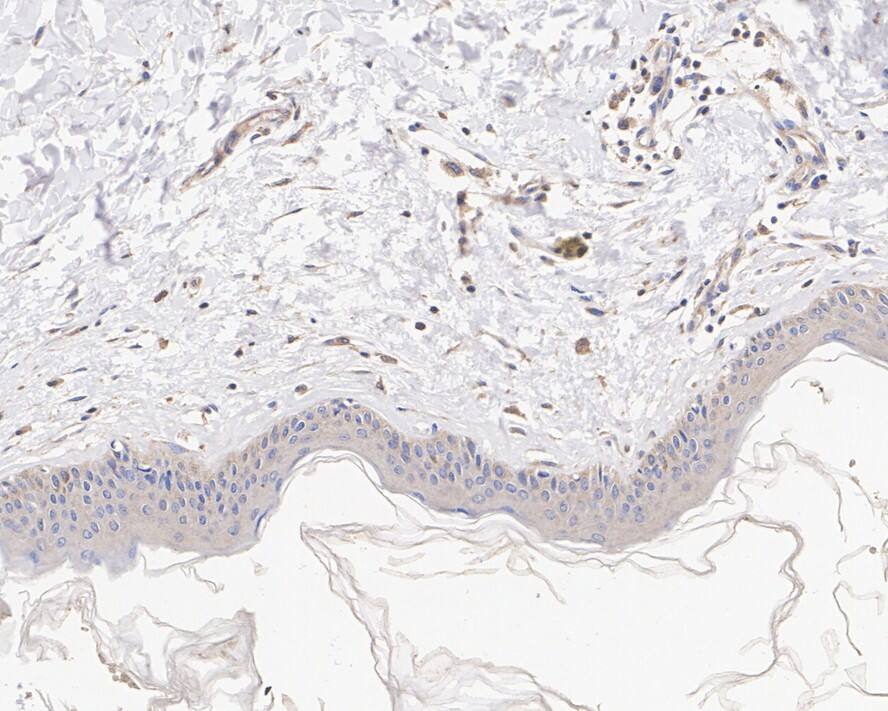 SAMD9 Antibody (PSH02-75)