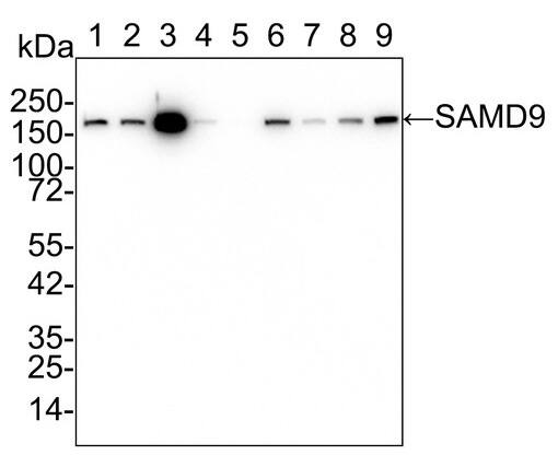 SAMD9 Antibody (PSH02-75)