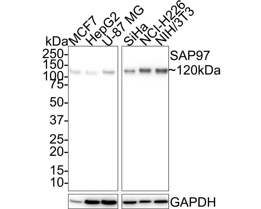 DLG1 Antibody (JE39-74)