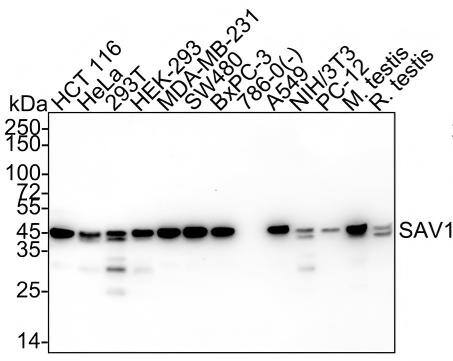 SAV1 Antibody (PSH04-45) Western Blot: SAV1 Antibody (PSH04-45) [NBP3-32931]