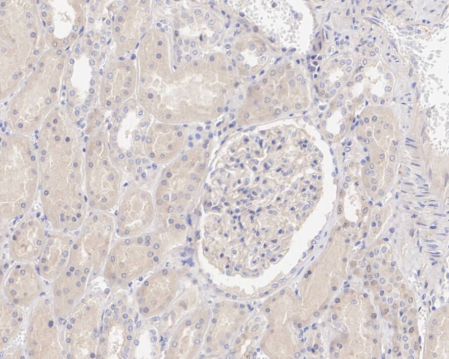 SAV1 Antibody (PSH04-45)