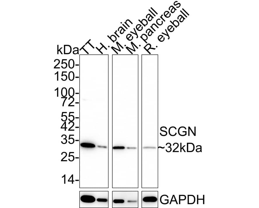 Secretagogin Antibody (JE60-48)