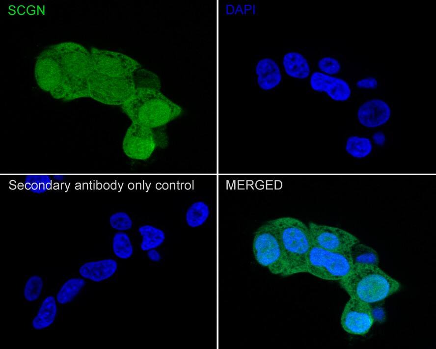 Secretagogin Antibody (JE60-48)