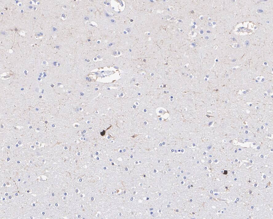 Secretagogin Antibody (JE60-48)