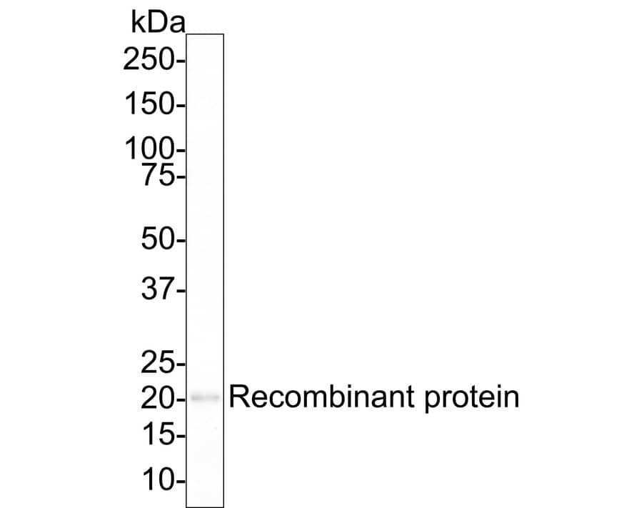 SCP3/SYCP3 Antibody (PSH02-24)