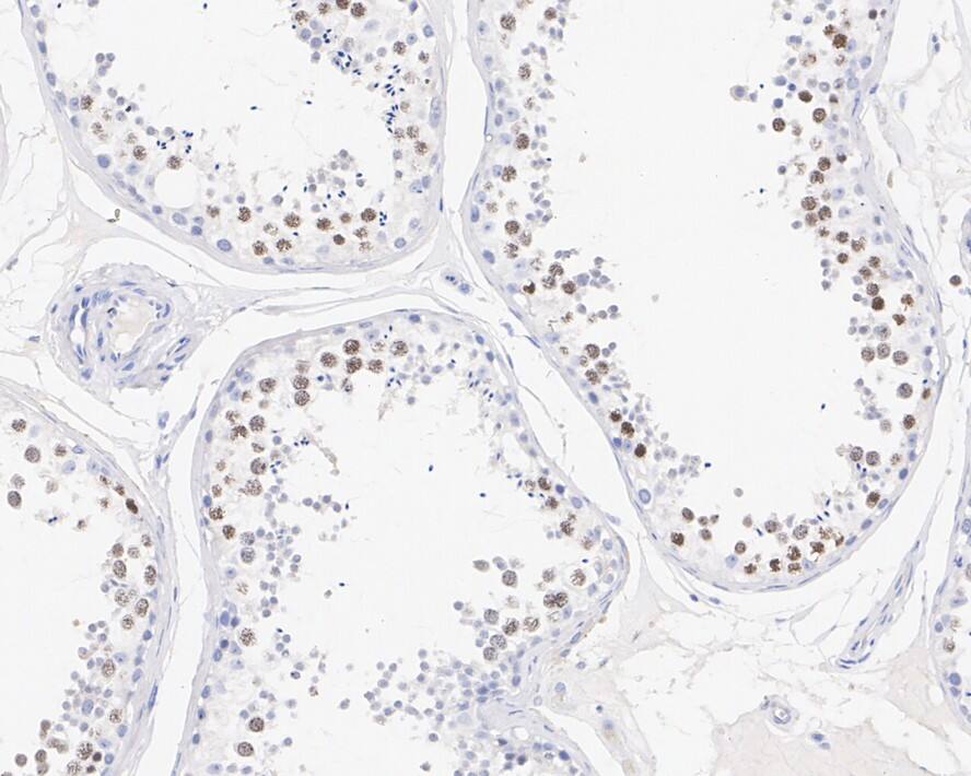 SCP3/SYCP3 Antibody (PSH02-24)