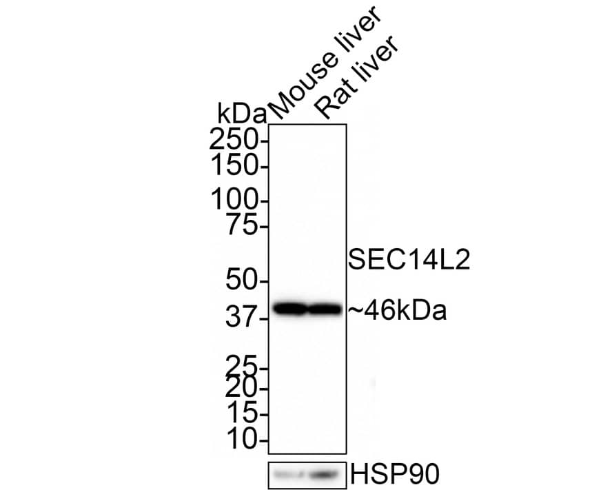 SEC14L2 Antibody (JE61-74)