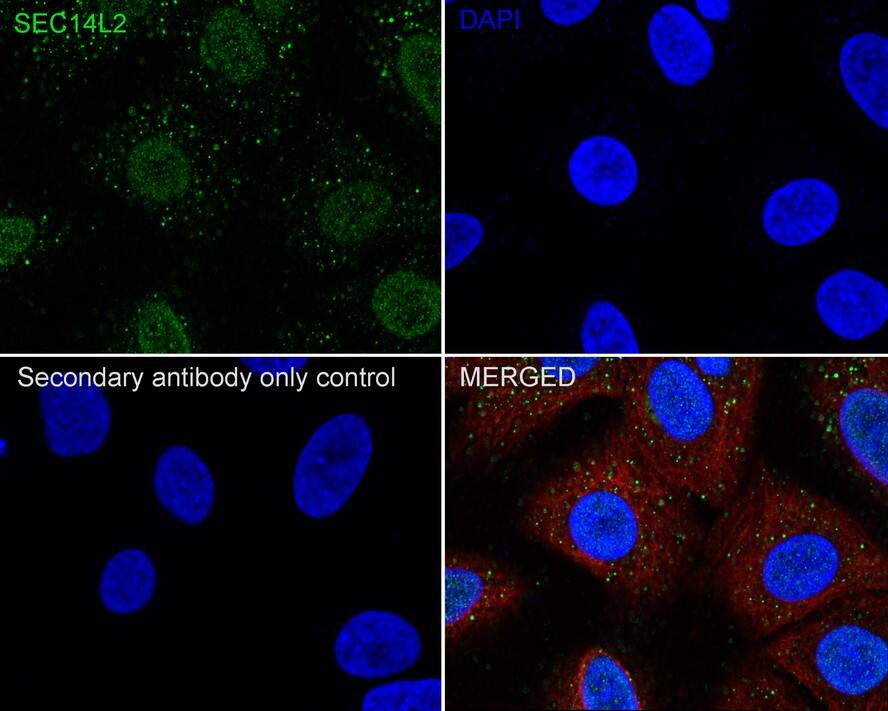 SEC14L2 Antibody (JE61-74)