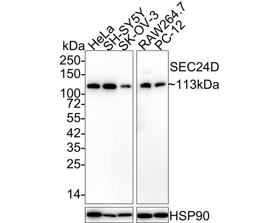 SEC24D Antibody (JE65-27)