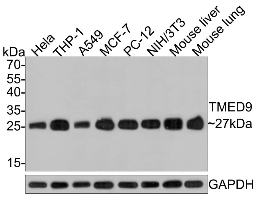 TMED9 Antibody (A9A7)