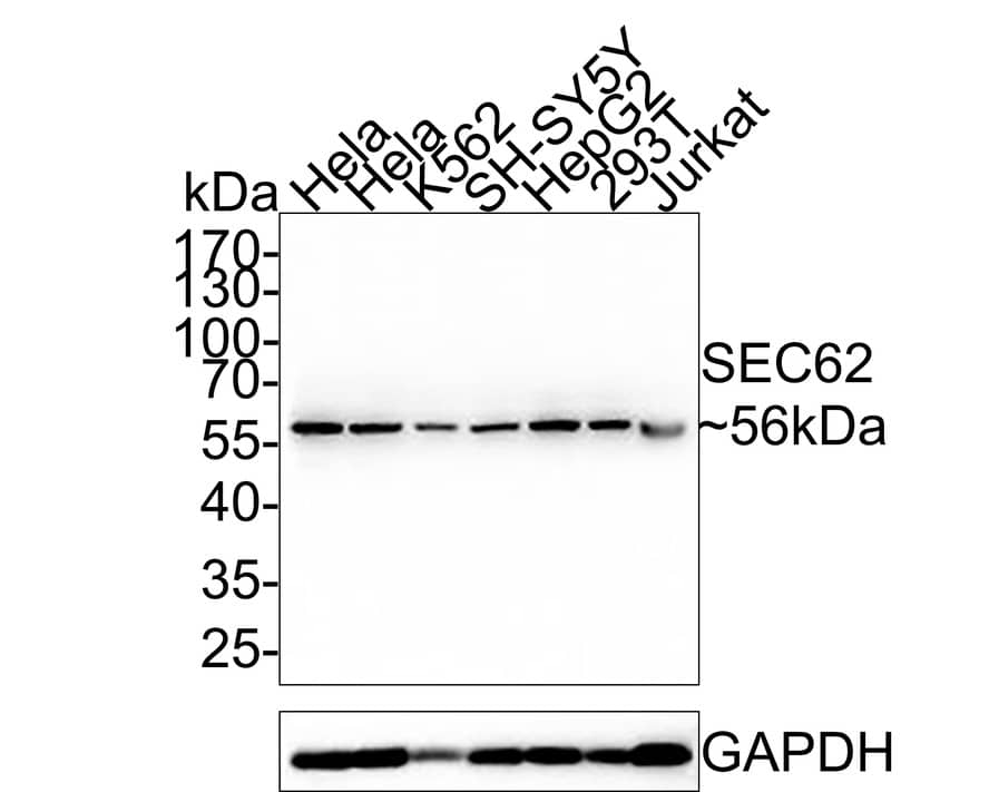 SEC62 Antibody (PSH0-25)