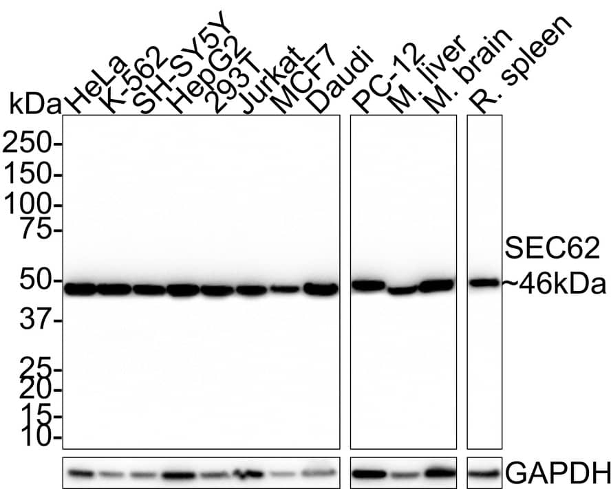 SEC62 Antibody (PSH0-91)