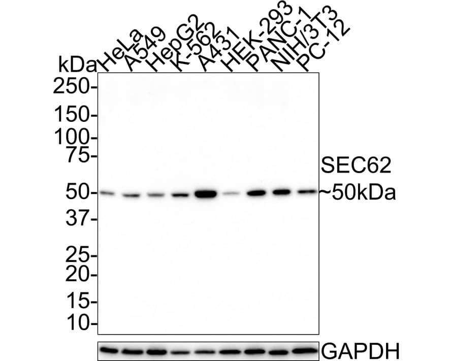 SEC62 Antibody (JE62-80)