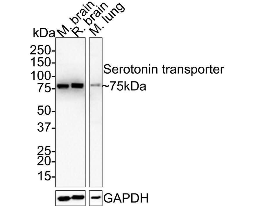 SLC6A4/5-HTTLPR/Serotonin transporter Antibody (JE34-53) Western Blot: SLC6A4/5-HTTLPR/Serotonin transporter Antibody (JE34-53) [NBP3-32944]