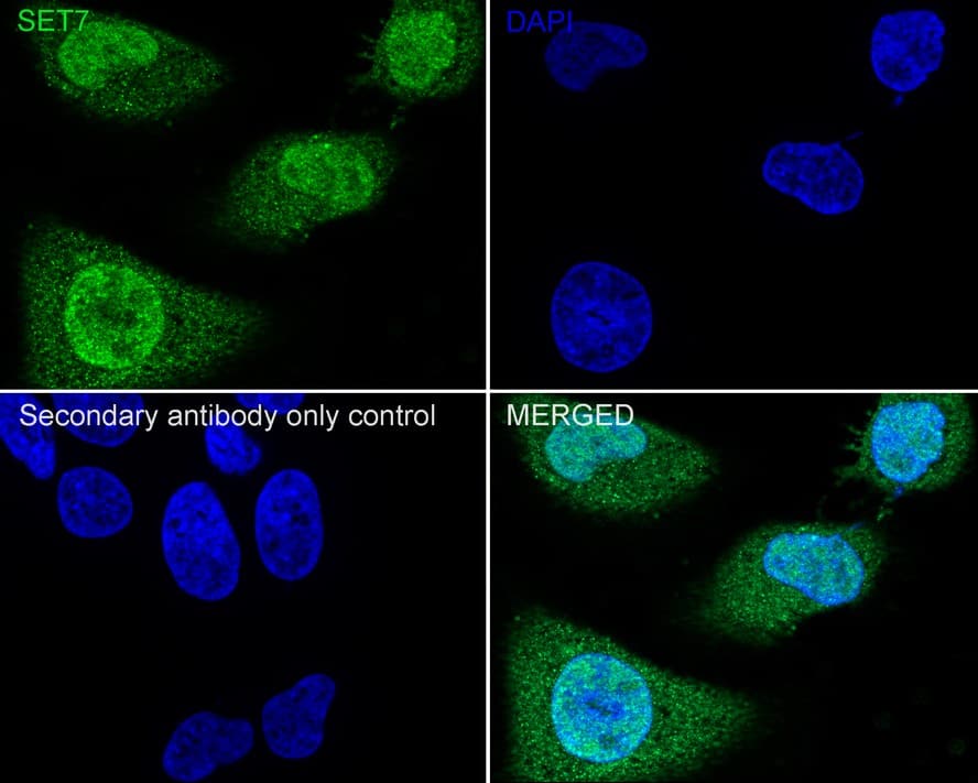 SETD7 Antibody (PSH02-90)