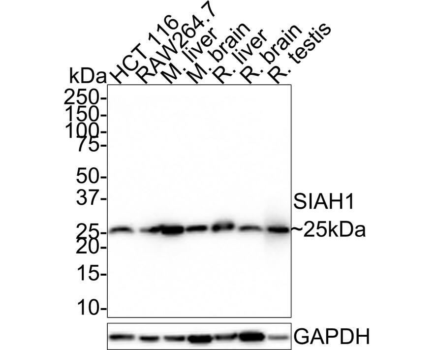 SIAH1 Antibody (PSH01-80)