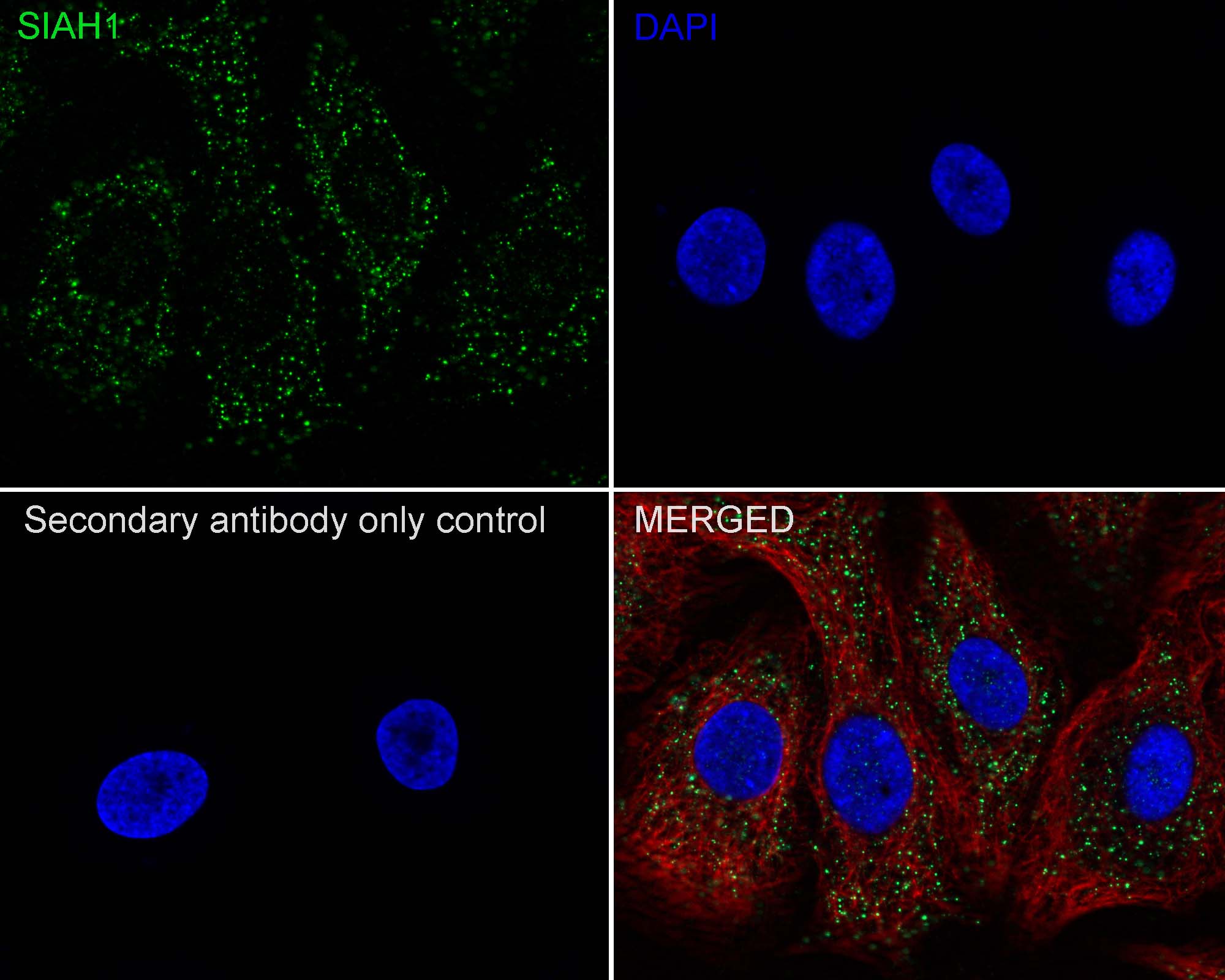 SIAH1 Antibody (PSH01-80)