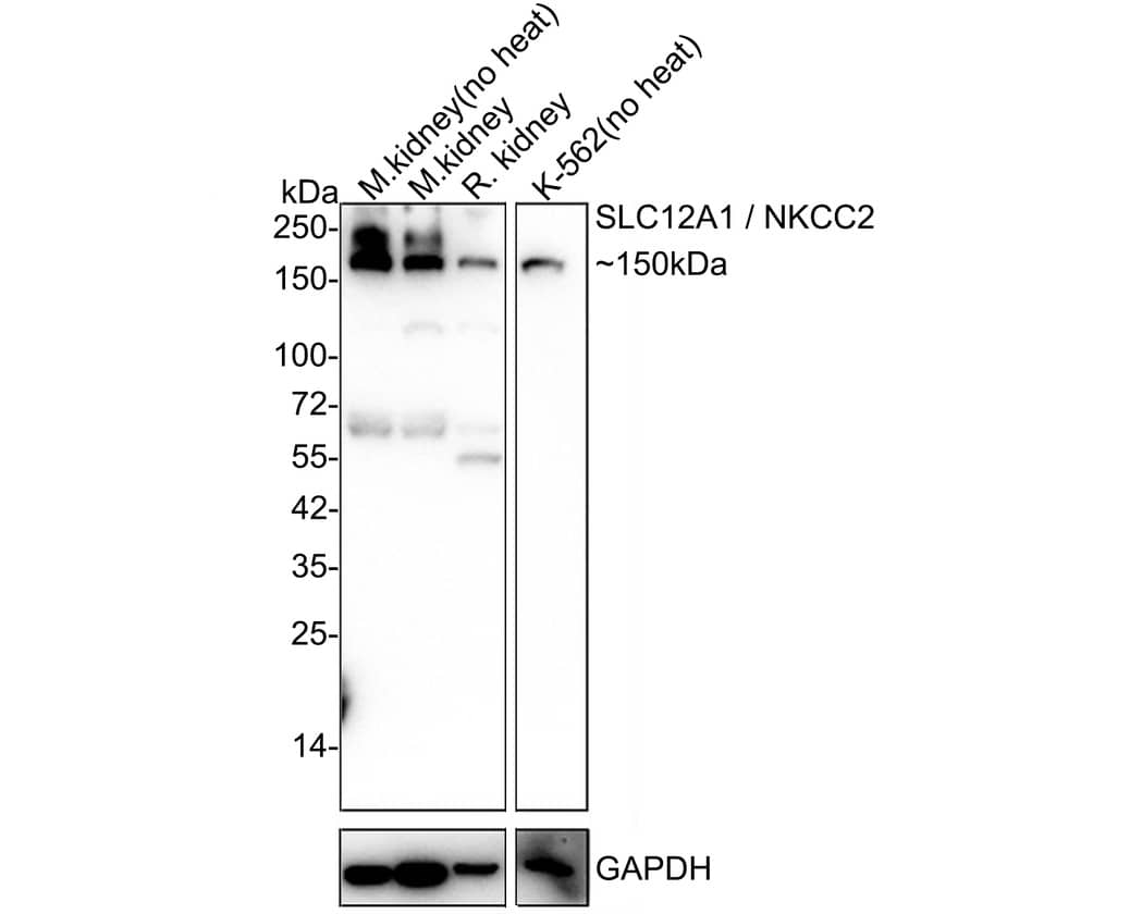 NKCC2/SLC12A1 Antibody (JE64-26)