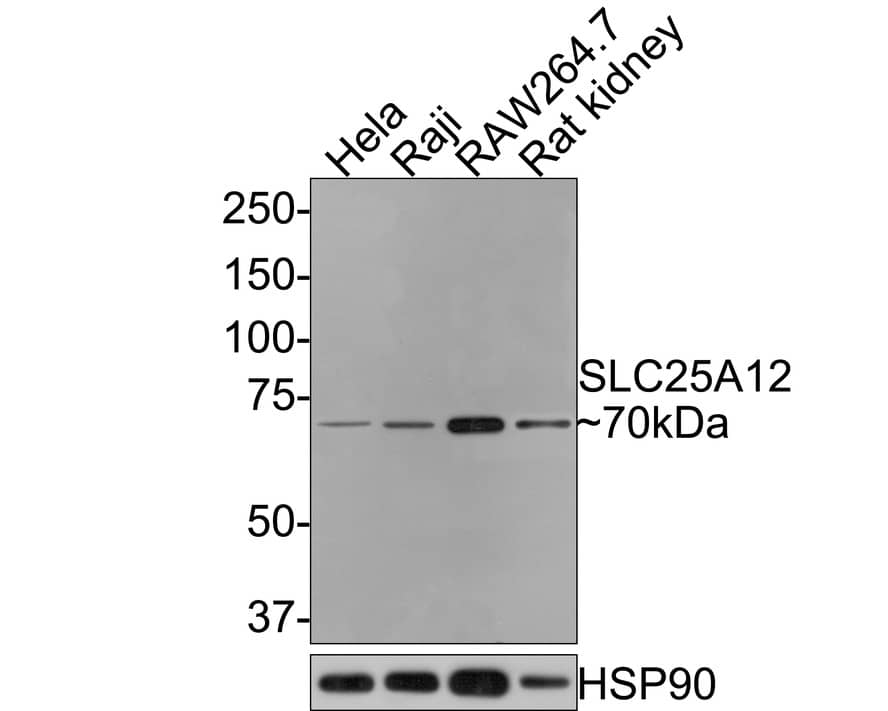 SLC25A12 Antibody (JE65-52)