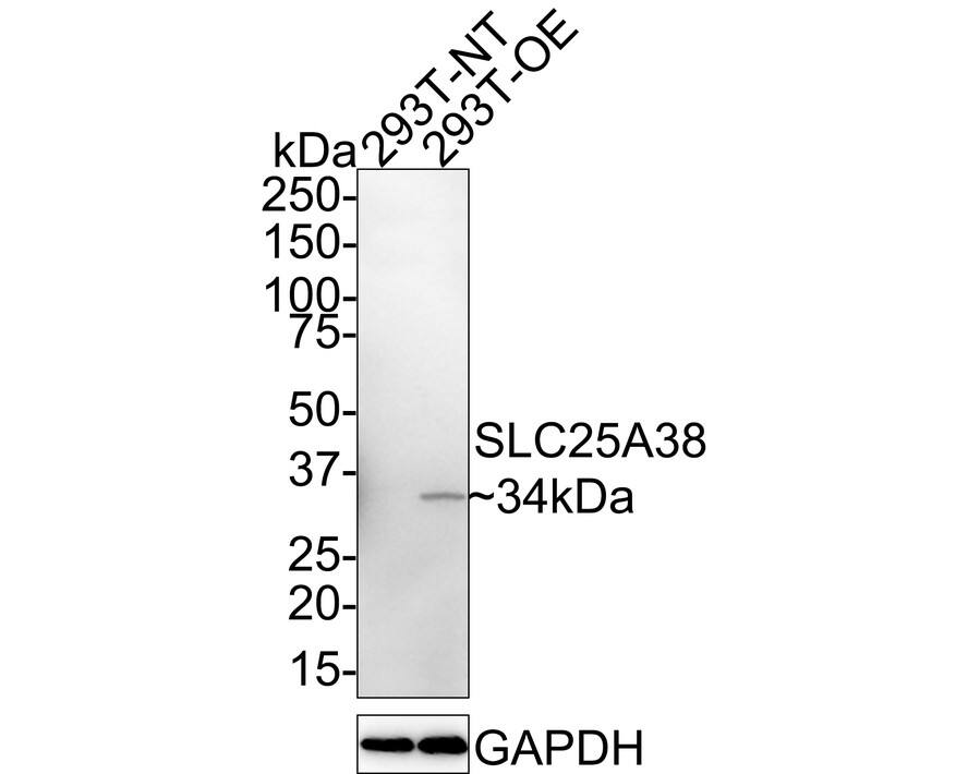 SLC25A38 Antibody (PSH02-79)