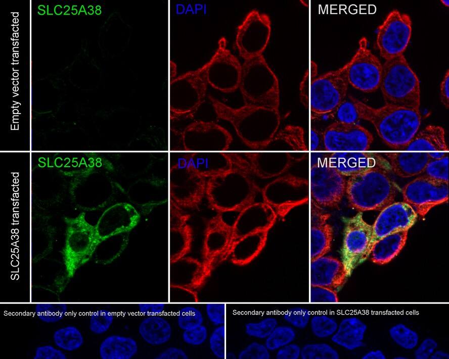 SLC25A38 Antibody (PSH02-79)