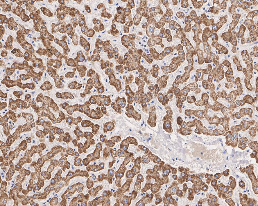 SLC25A38 Antibody (PSH02-79)