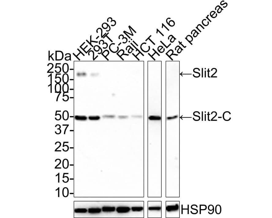 Slit2 Antibody (JE31-87)