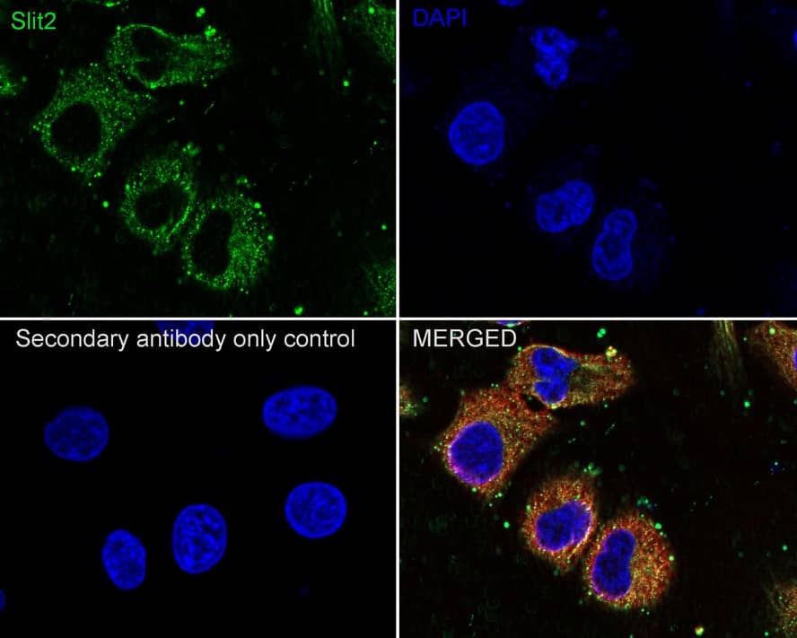 Slit2 Antibody (JE31-87)