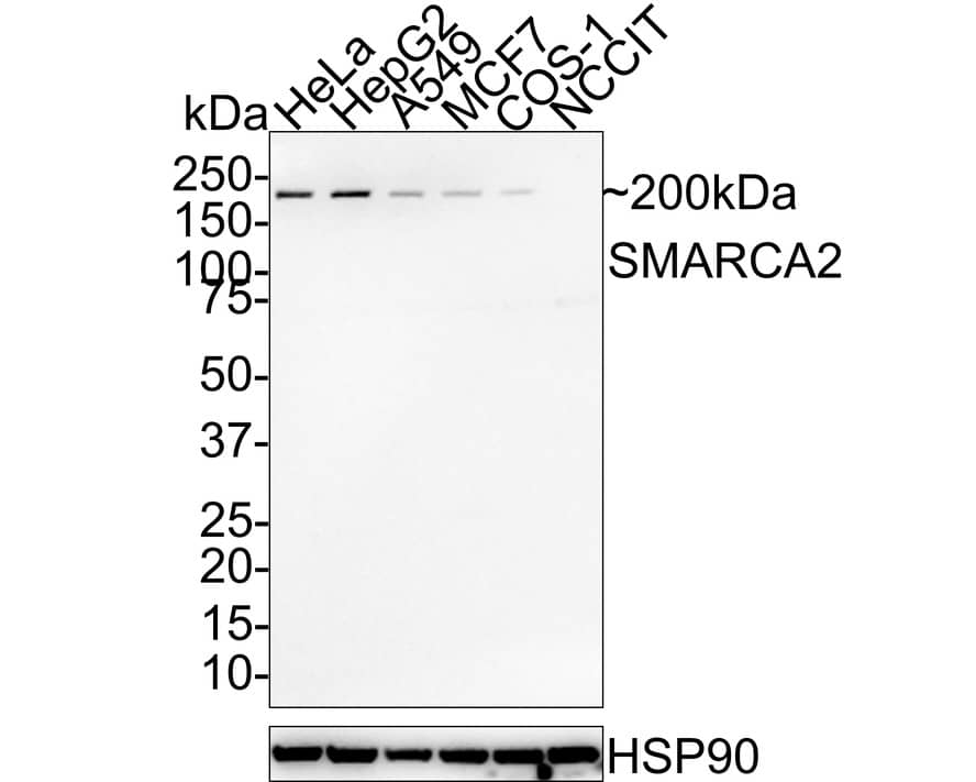 BRM Antibody (PSH01-15)