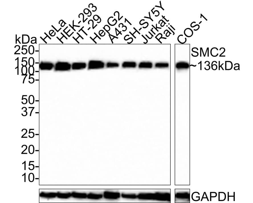 SMC2 Antibody (PSH0-62)