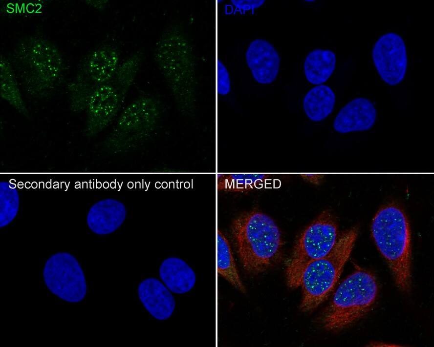 SMC2 Antibody (PSH0-62)