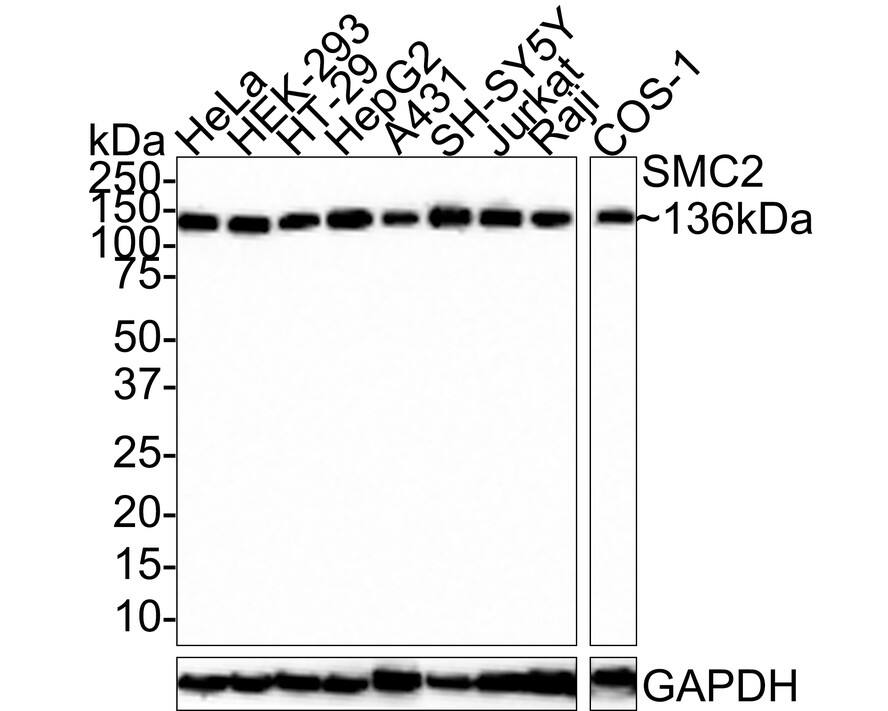 SMC2 Antibody (PSH0-63)