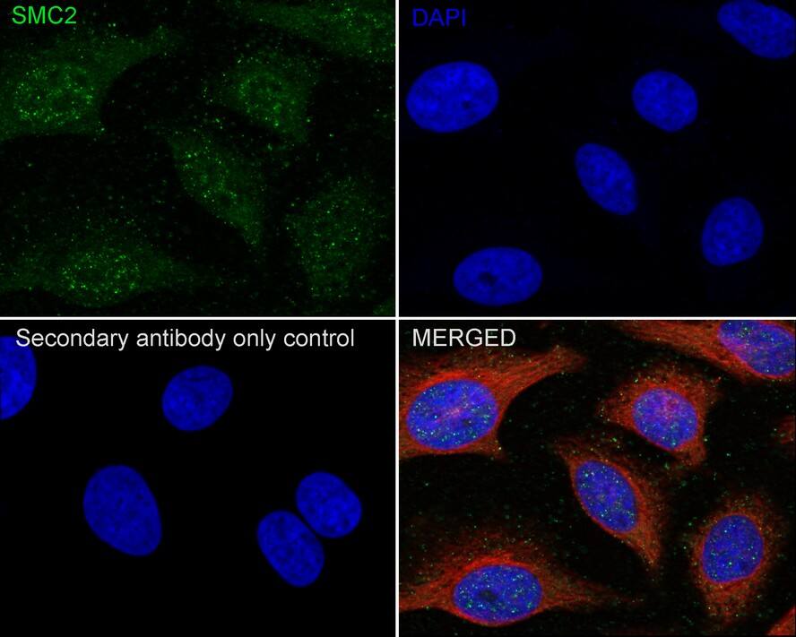 SMC2 Antibody (PSH0-63)