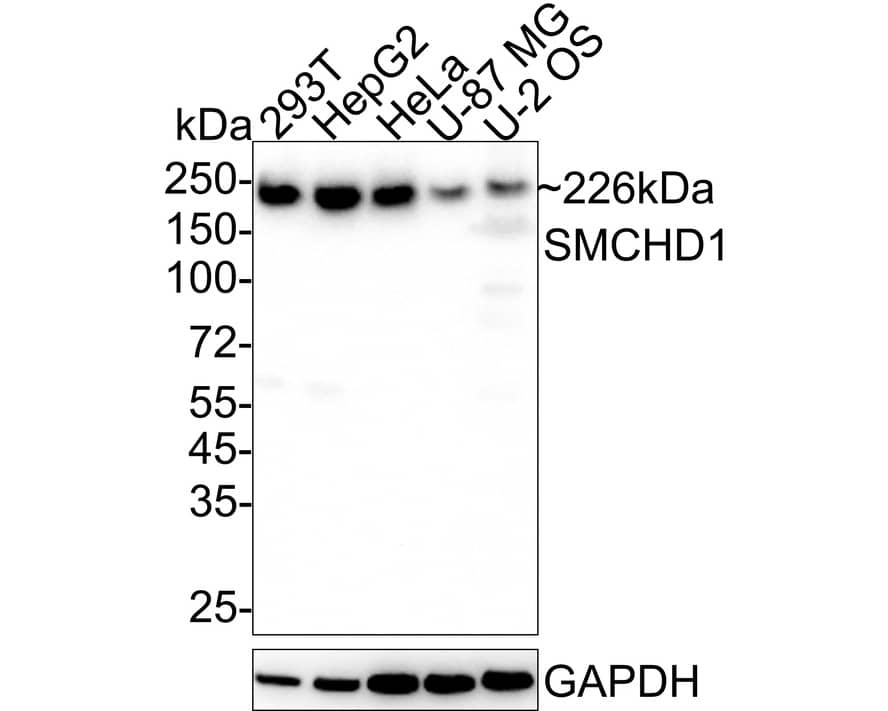 SMCHD1 Antibody (JE34-29)