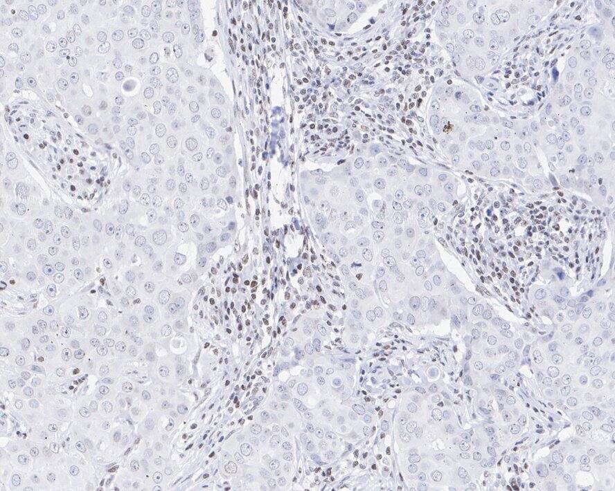 SMCHD1 Antibody (JE34-29)