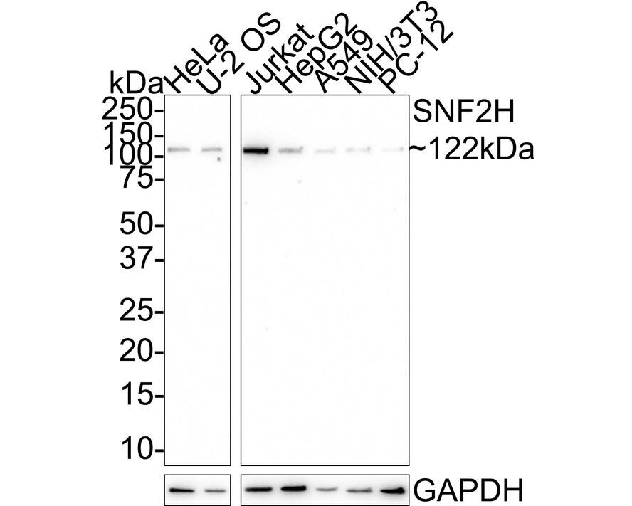 SMARCA5/SNF2H Antibody (JE40-44)