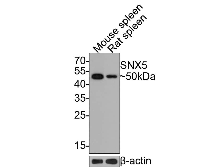 SNX5 Antibody (JE64-96)