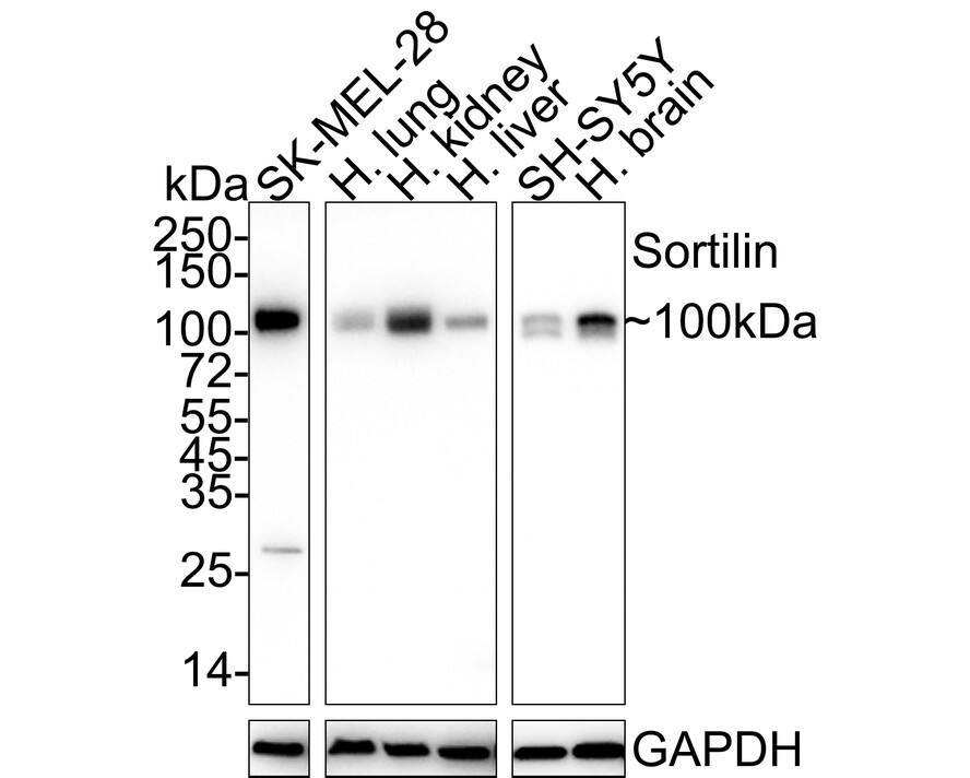 Sortilin Antibody (JE60-00)