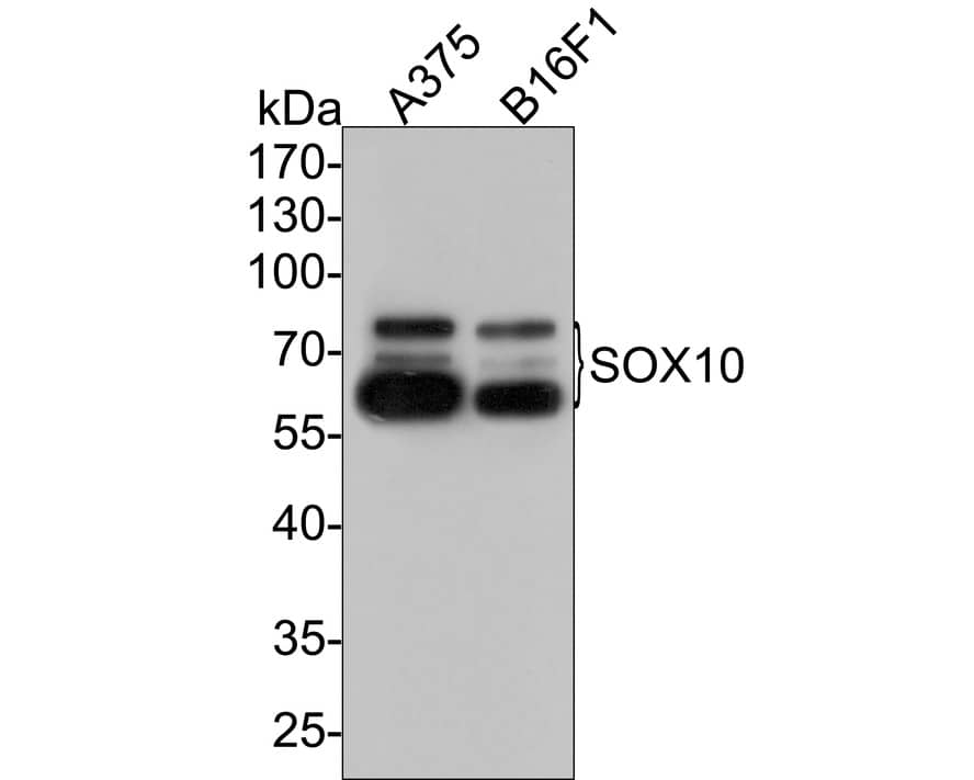 SOX10 Antibody (PDH0-05)