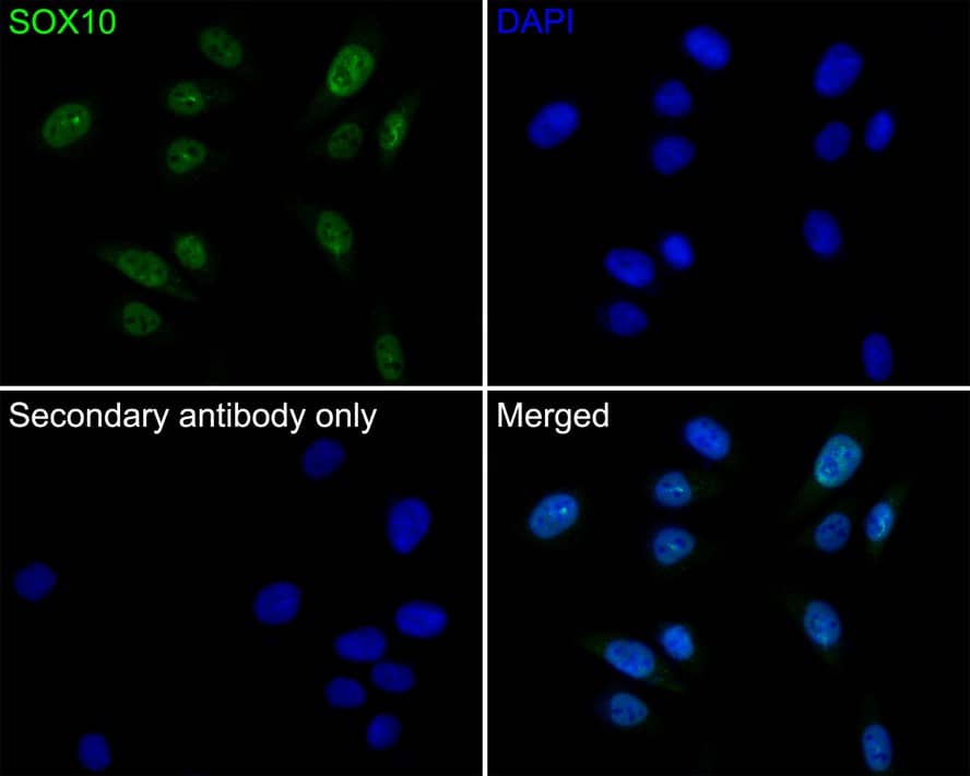 SOX10 Antibody (PDH0-03)