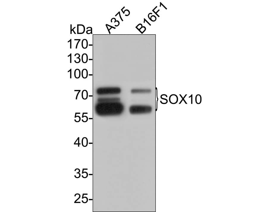 SOX10 Antibody (PDH0-04)