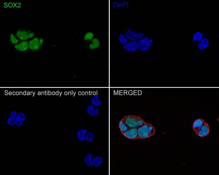SOX2 Antibody (PO00-28)