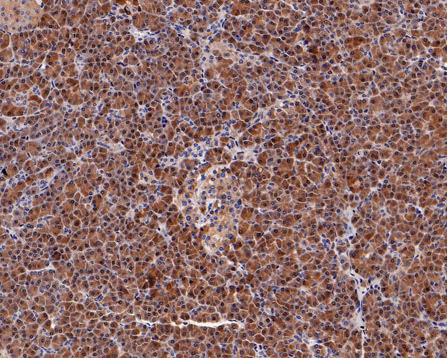 SPINK1 Antibody (PD00-93)