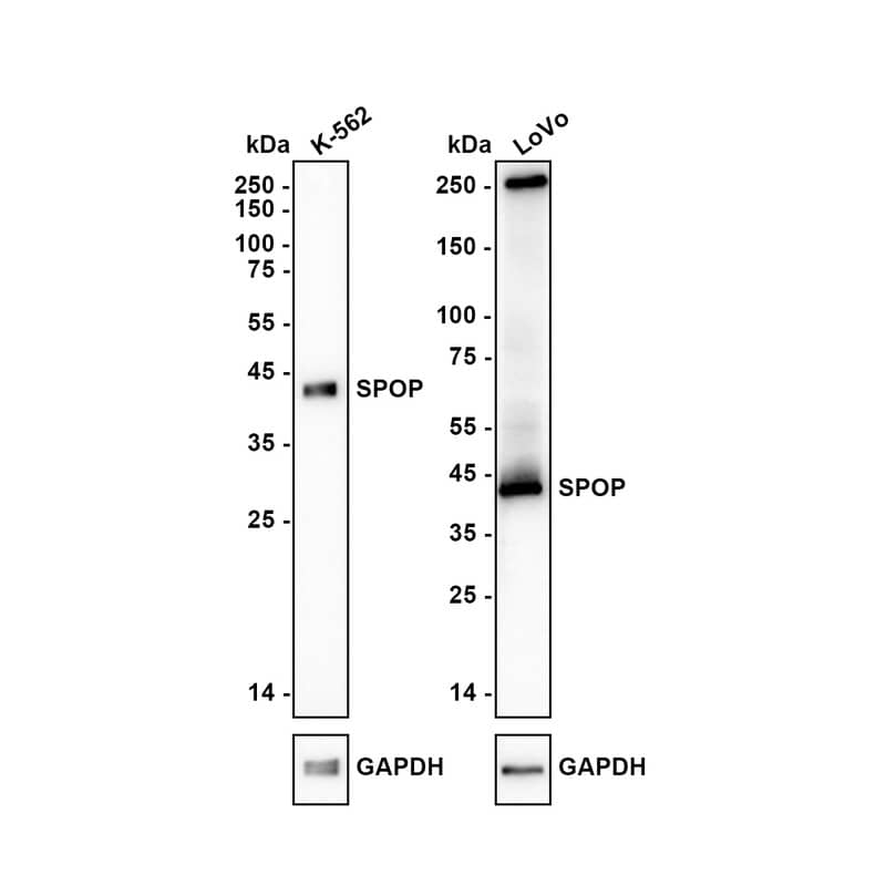 SPOP Antibody (JE36-04) Western Blot: SPOP Antibody (JE36-04) [NBP3-32976]