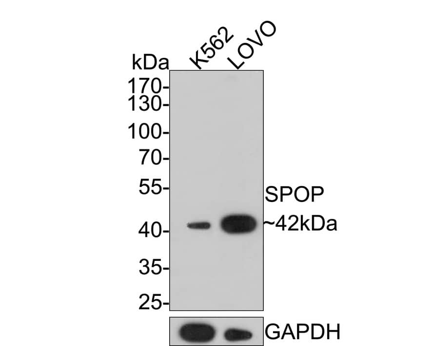 SPOP Antibody (JE36-04)