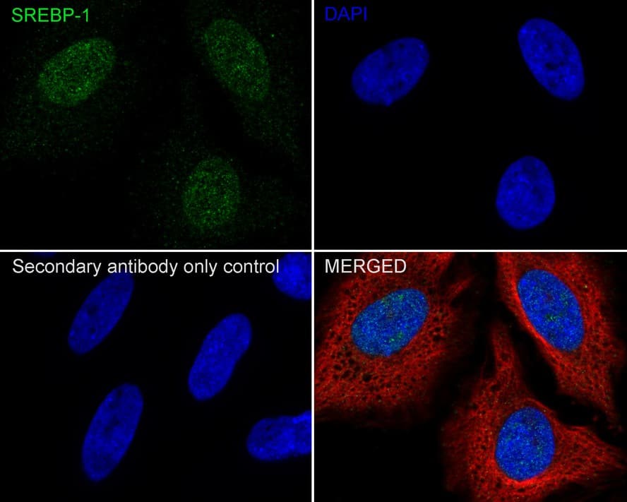 SREBP1 Antibody (PSH04-61)