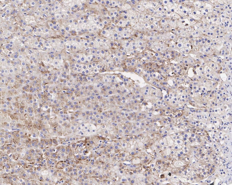 SREBP1 Antibody (PSH04-61)