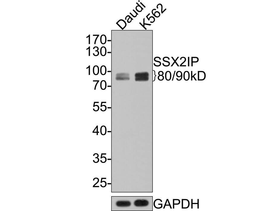 SSX2IP Antibody (JE65-50) Western Blot: SSX2IP Antibody (JE65-50) [NBP3-32978]