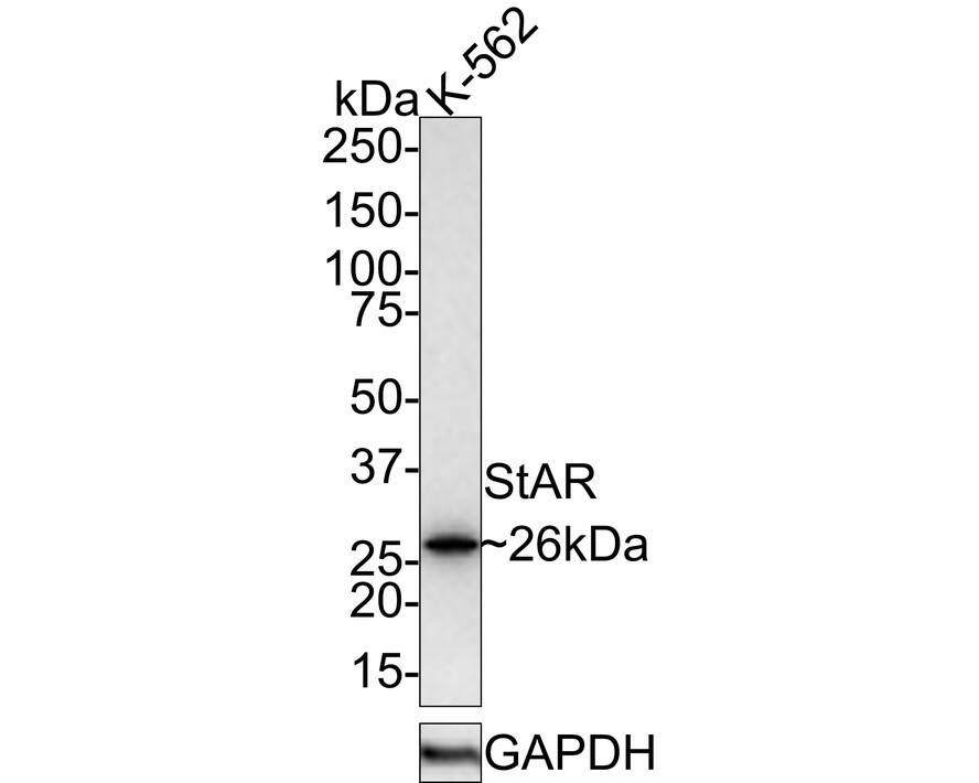 StAR Antibody (JE32-23)